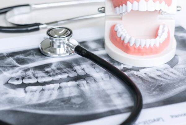 La panoramica dentale​